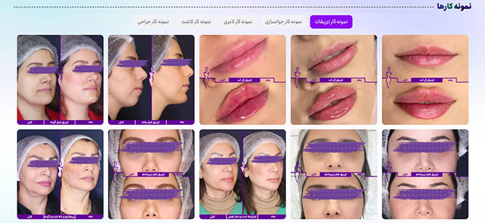 معرفی نمونه کار سایت خدمات پوستی معرفی نمونه کار سایت خدمات پوستی